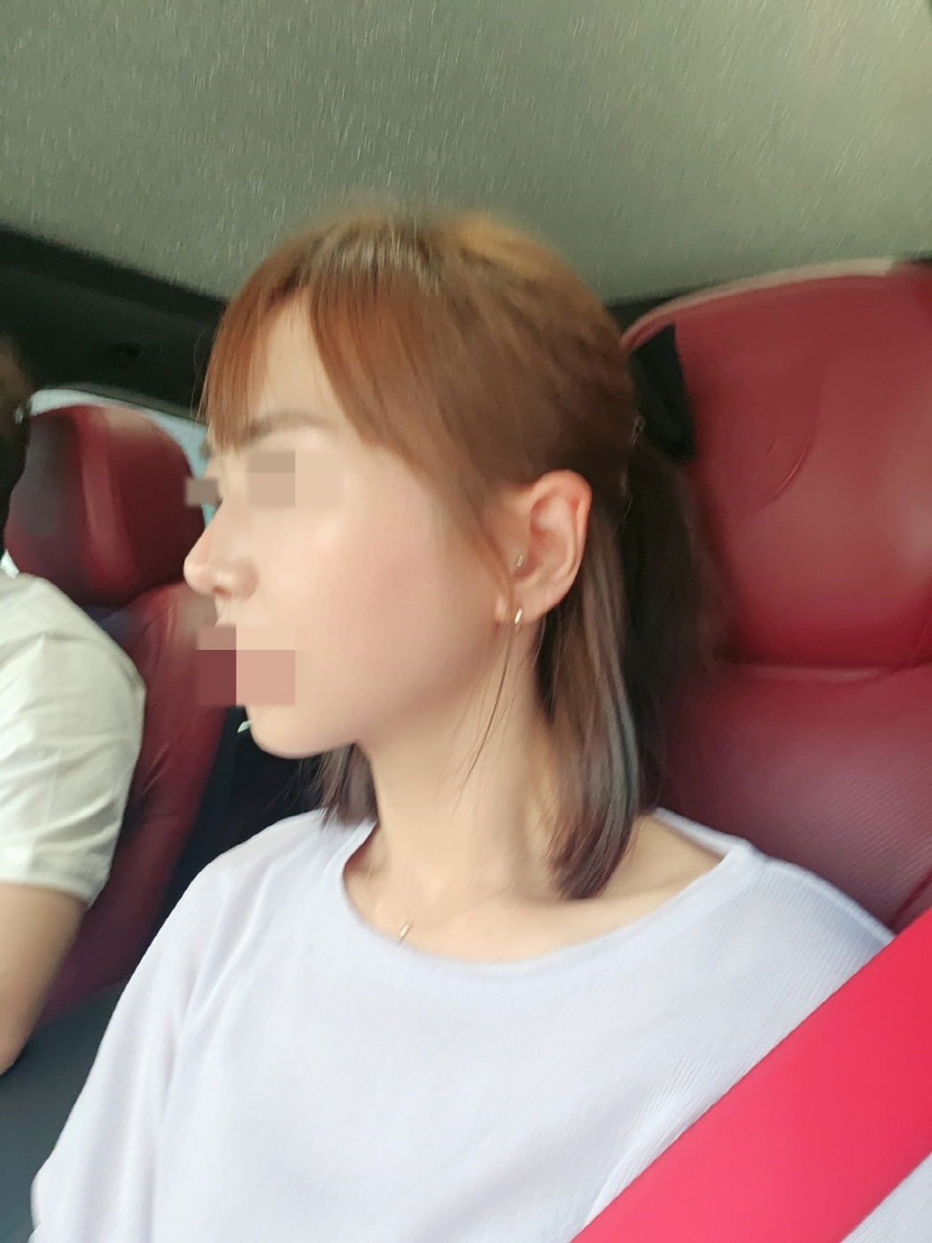 수술후기이미지