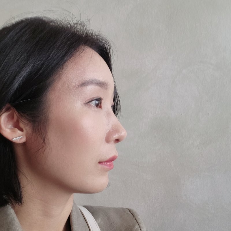 수술후기이미지