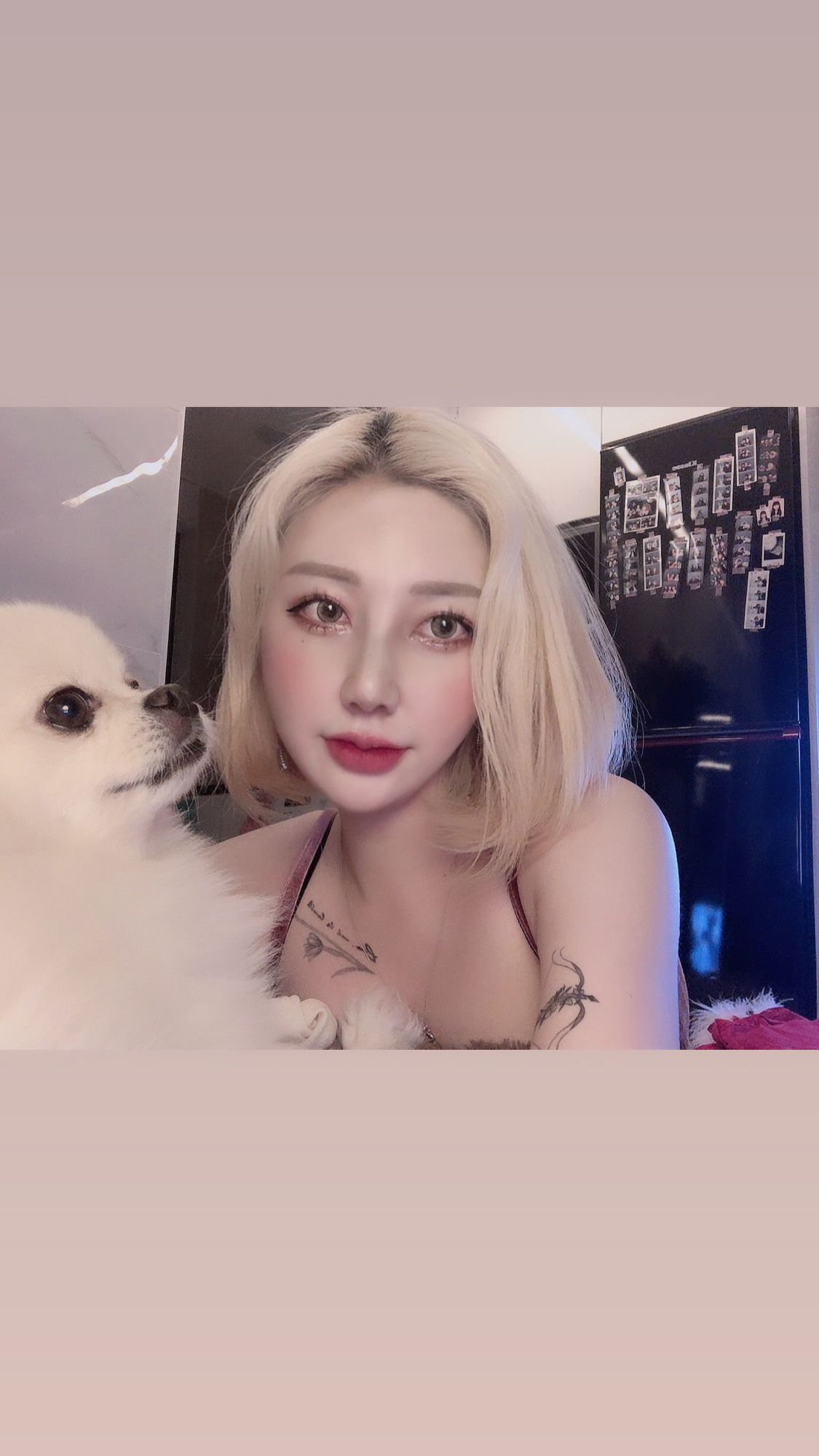 수술후기이미지