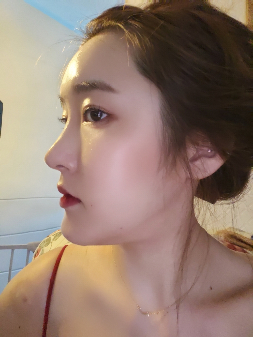 수술후기이미지