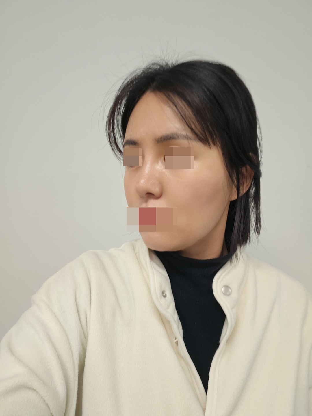 수술후기이미지