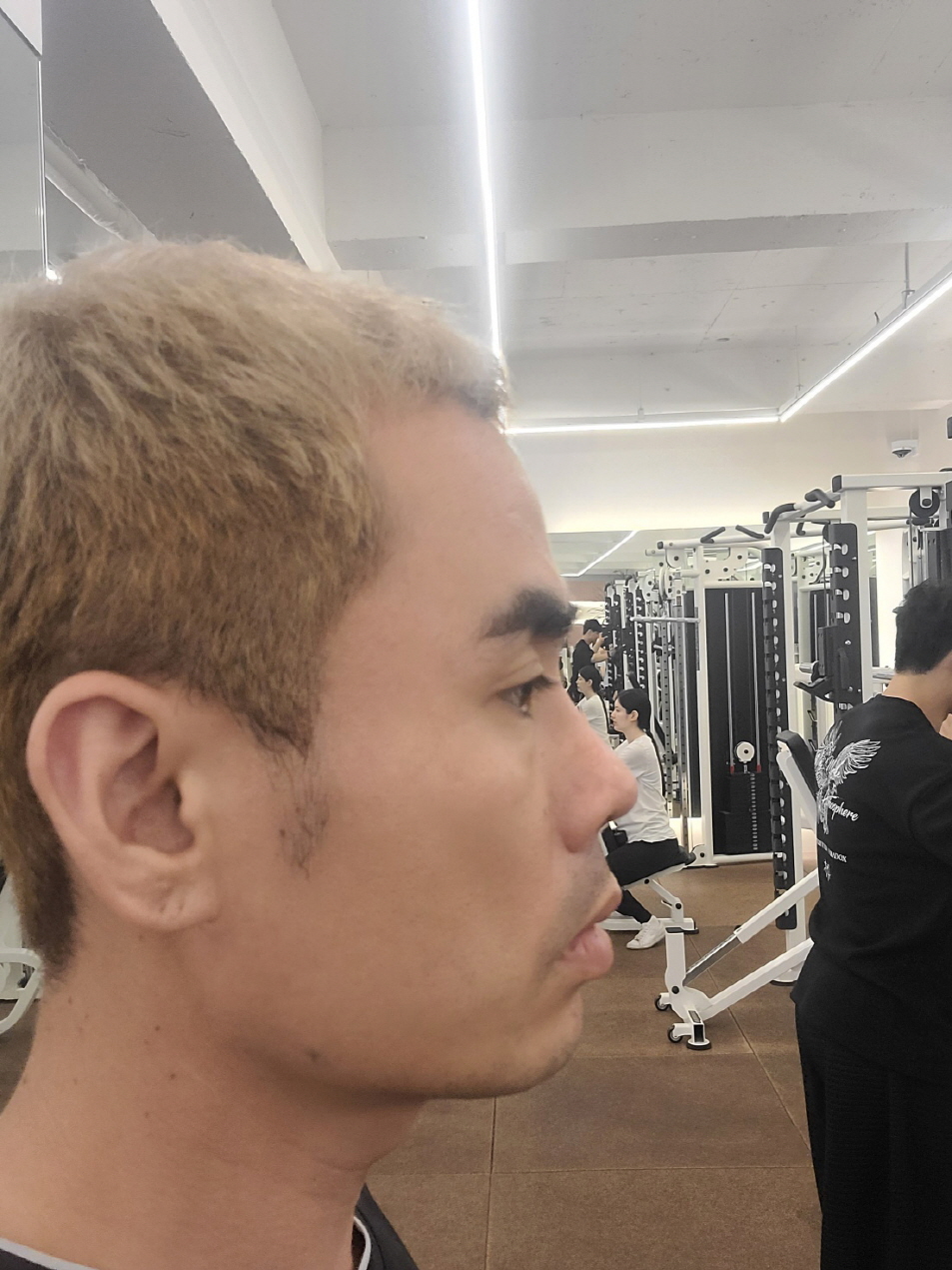 수술후기이미지