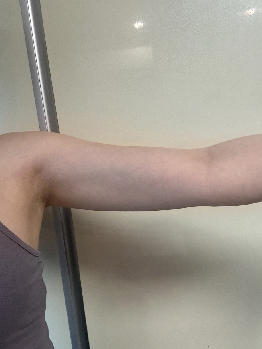 수술후기이미지