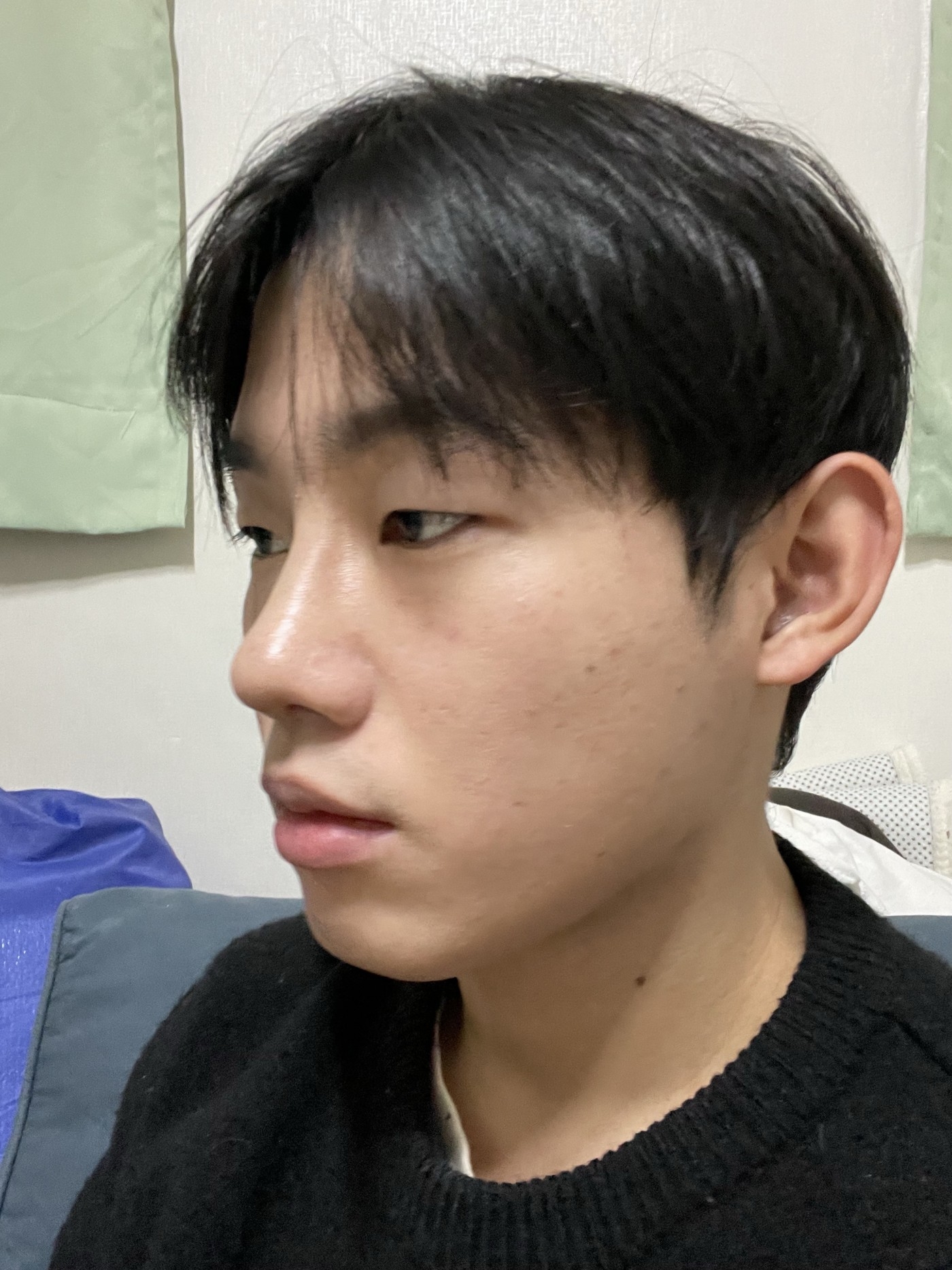 수술후기이미지