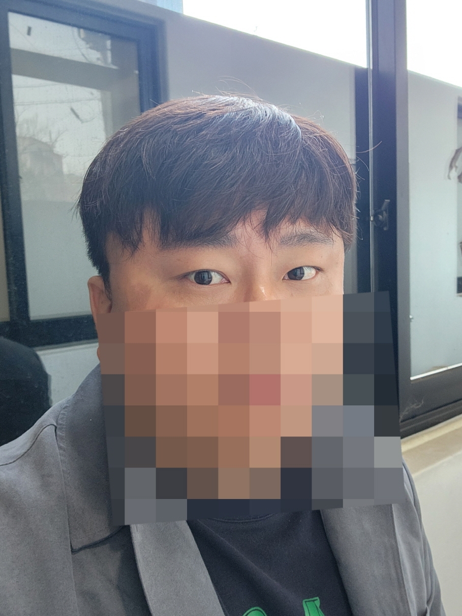 수술후기이미지