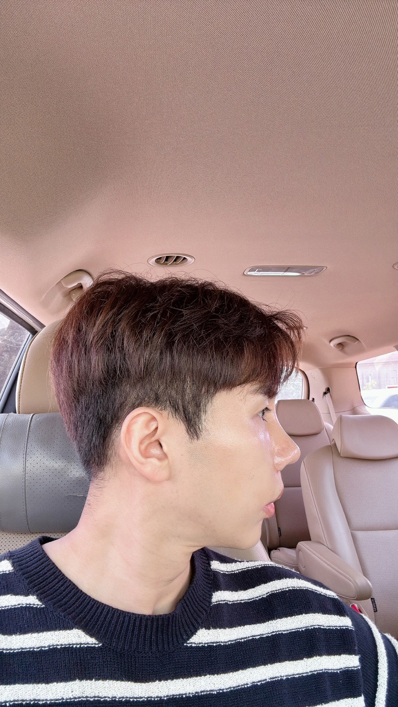 수술후기이미지