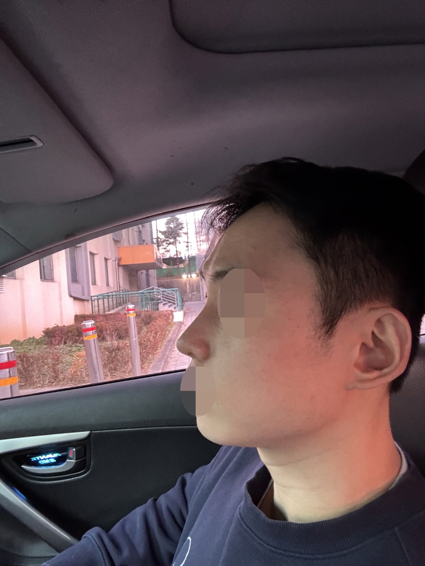 수술후기이미지