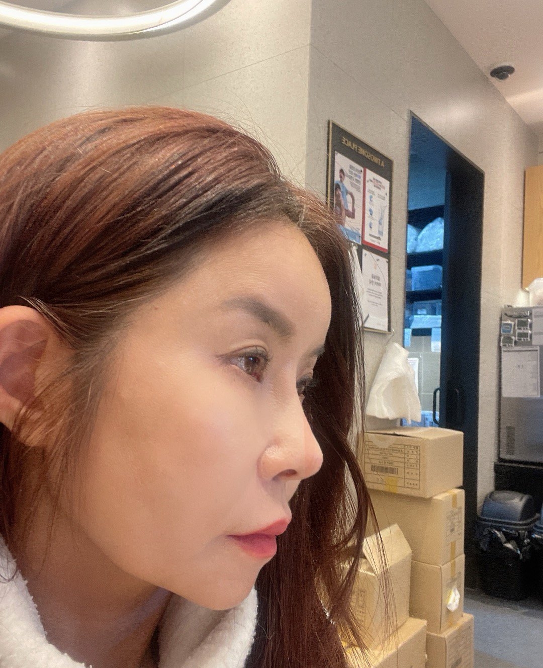 수술후기이미지