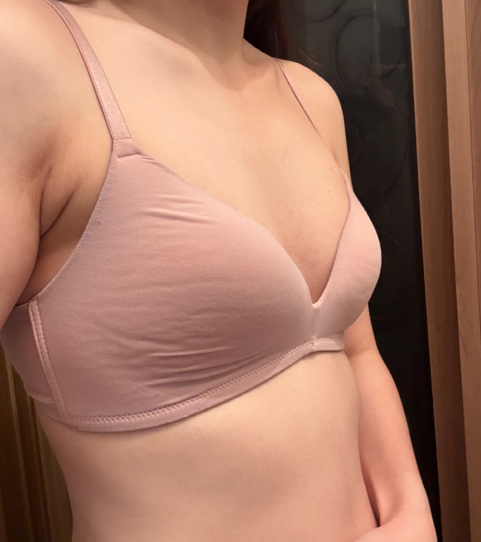 수술후기이미지