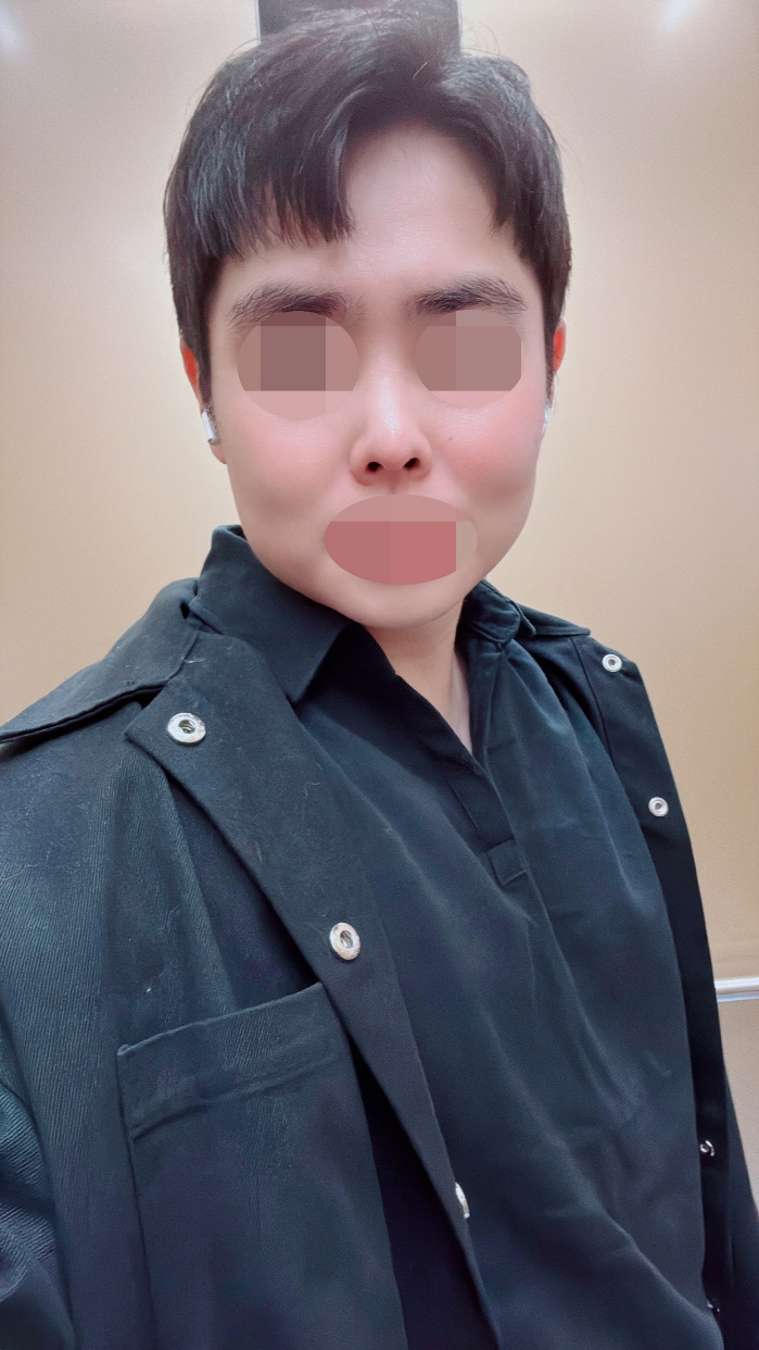 수술후기이미지