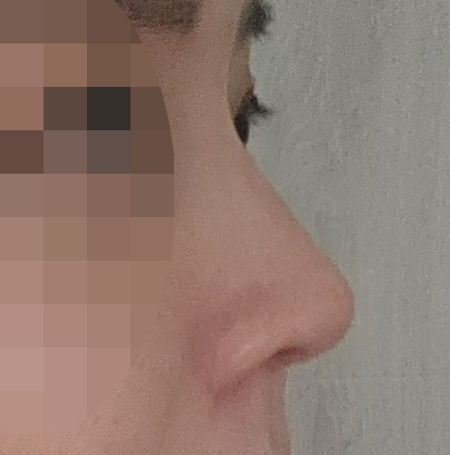 수술후기이미지