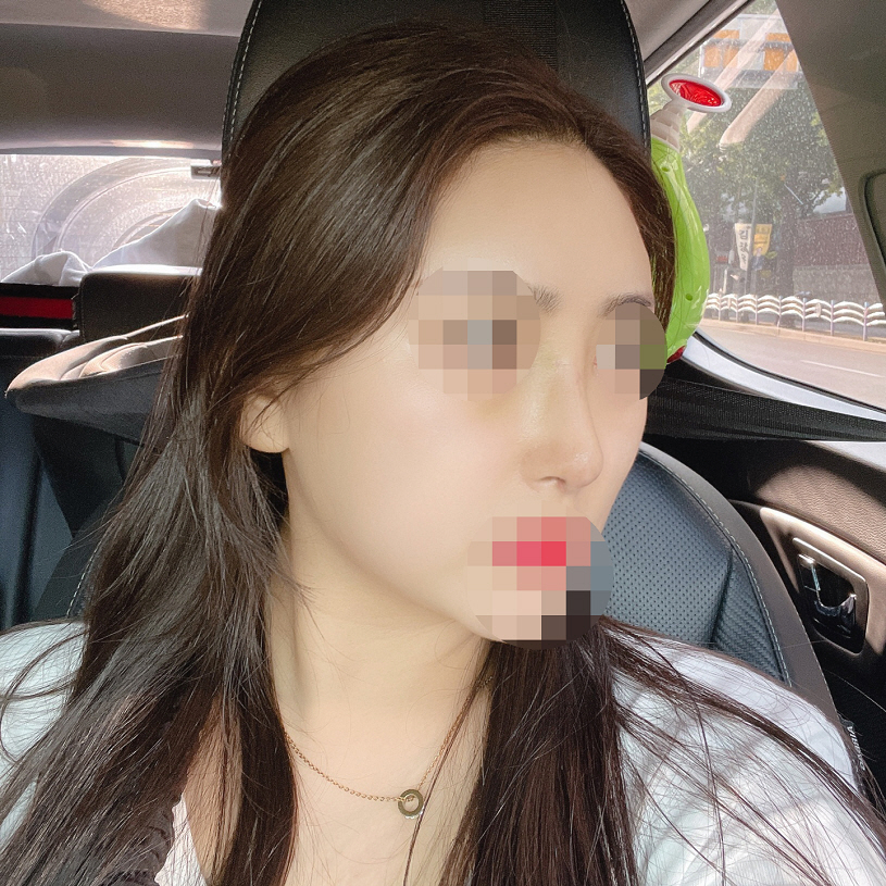 수술후기이미지