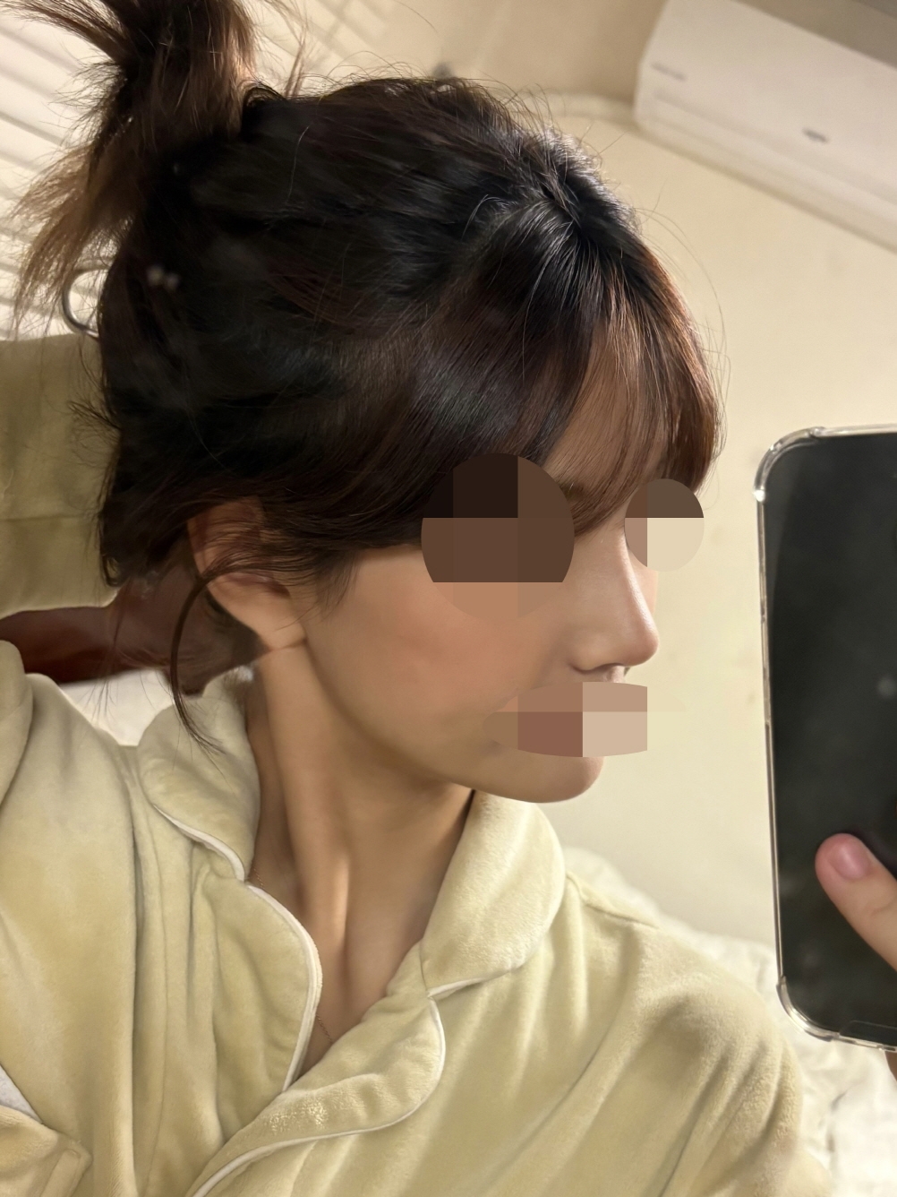 수술후기이미지