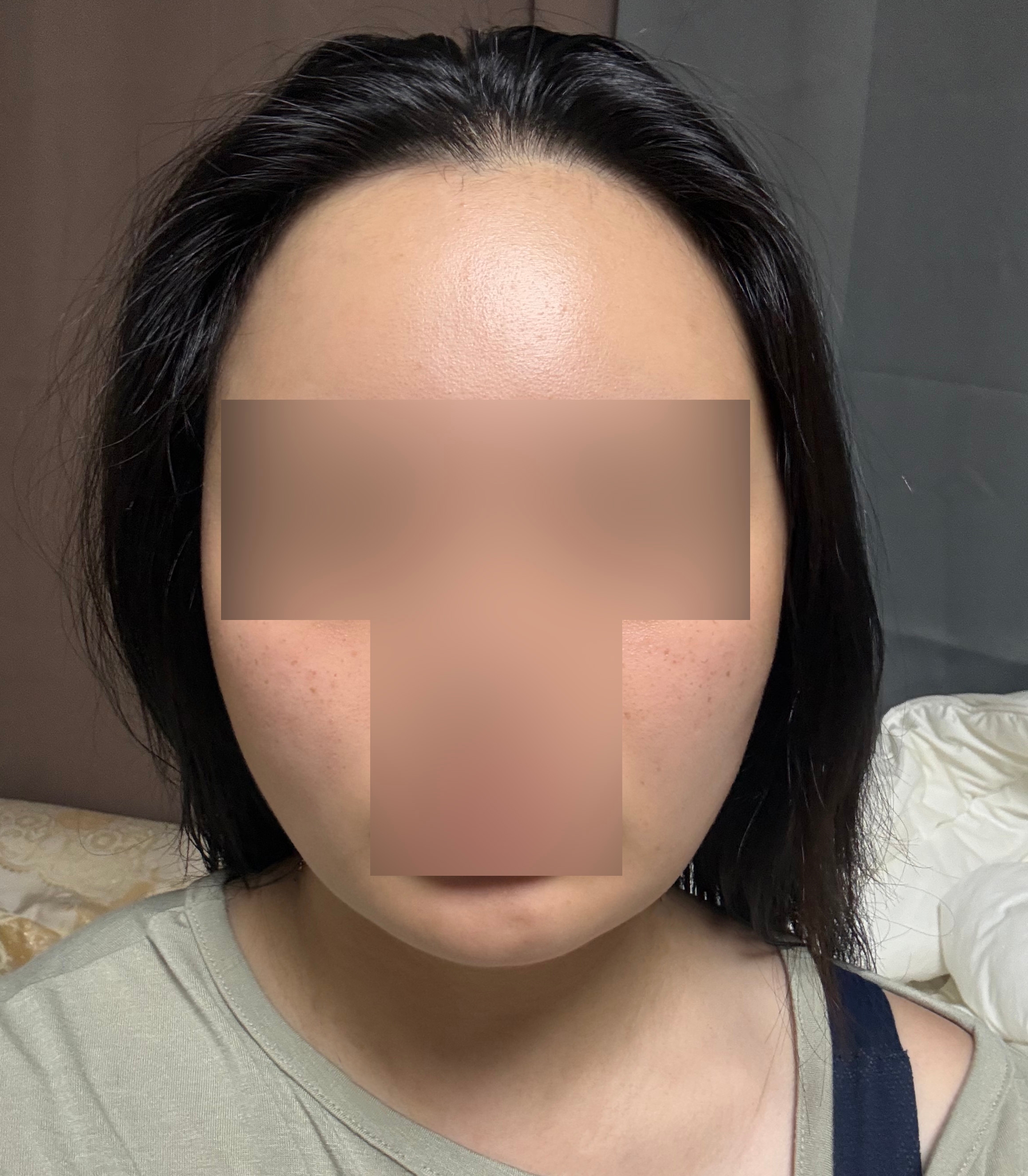 수술후기이미지