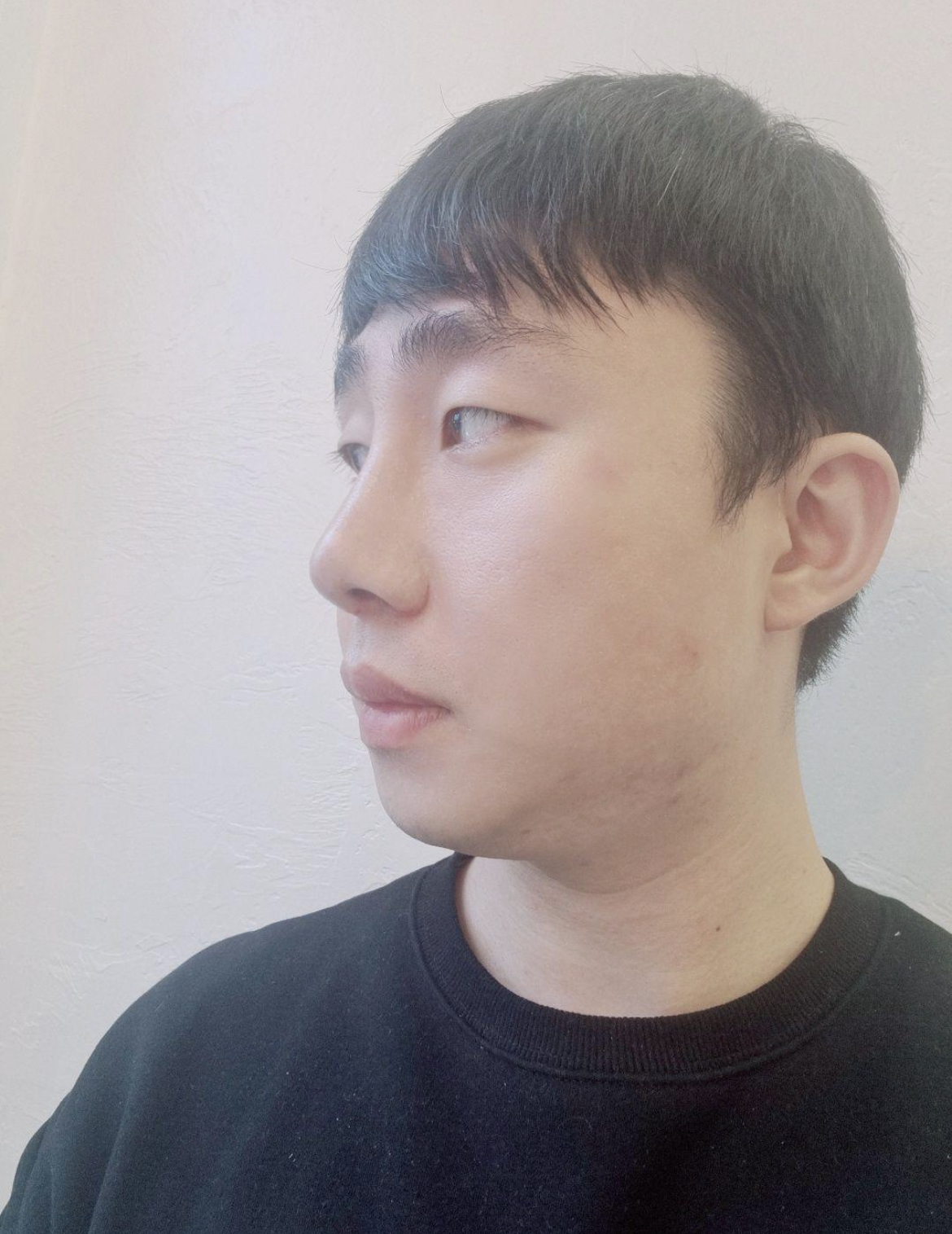 수술후기이미지