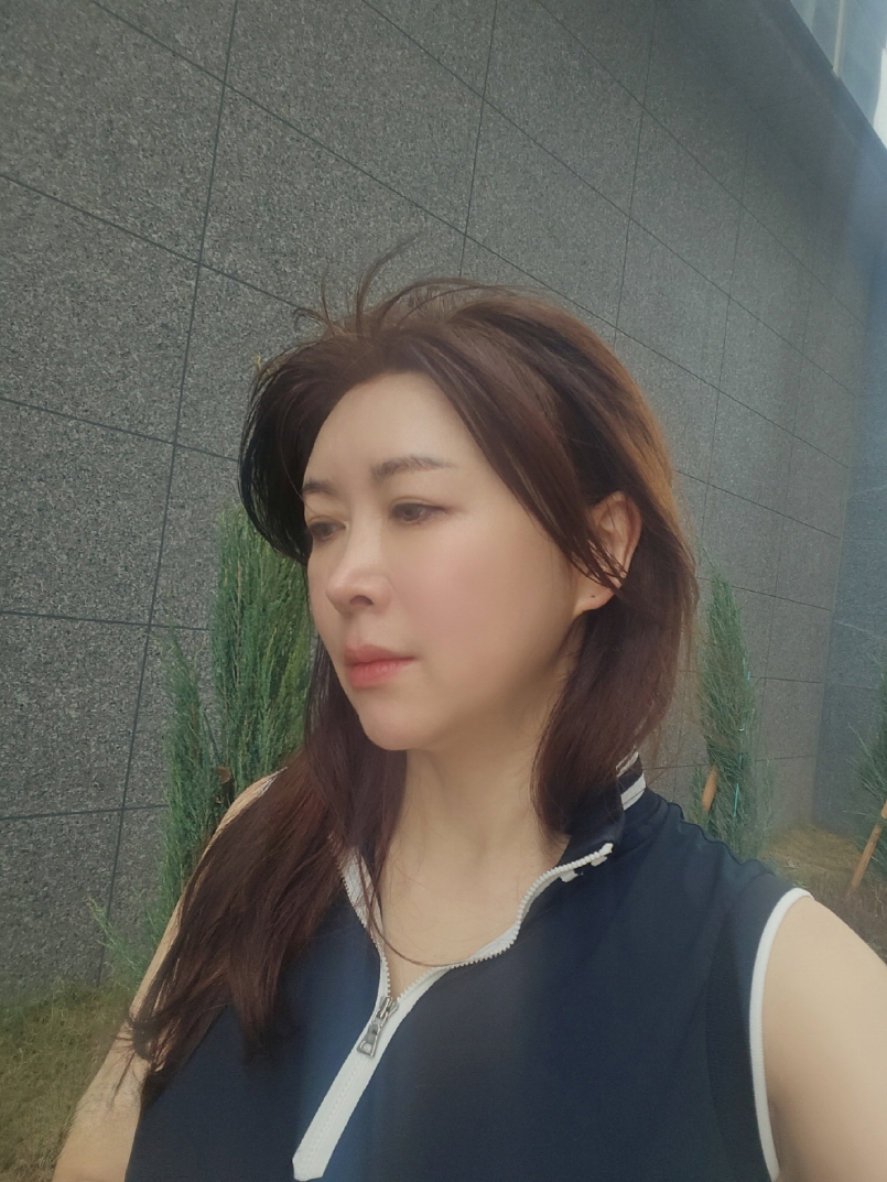 수술후기이미지