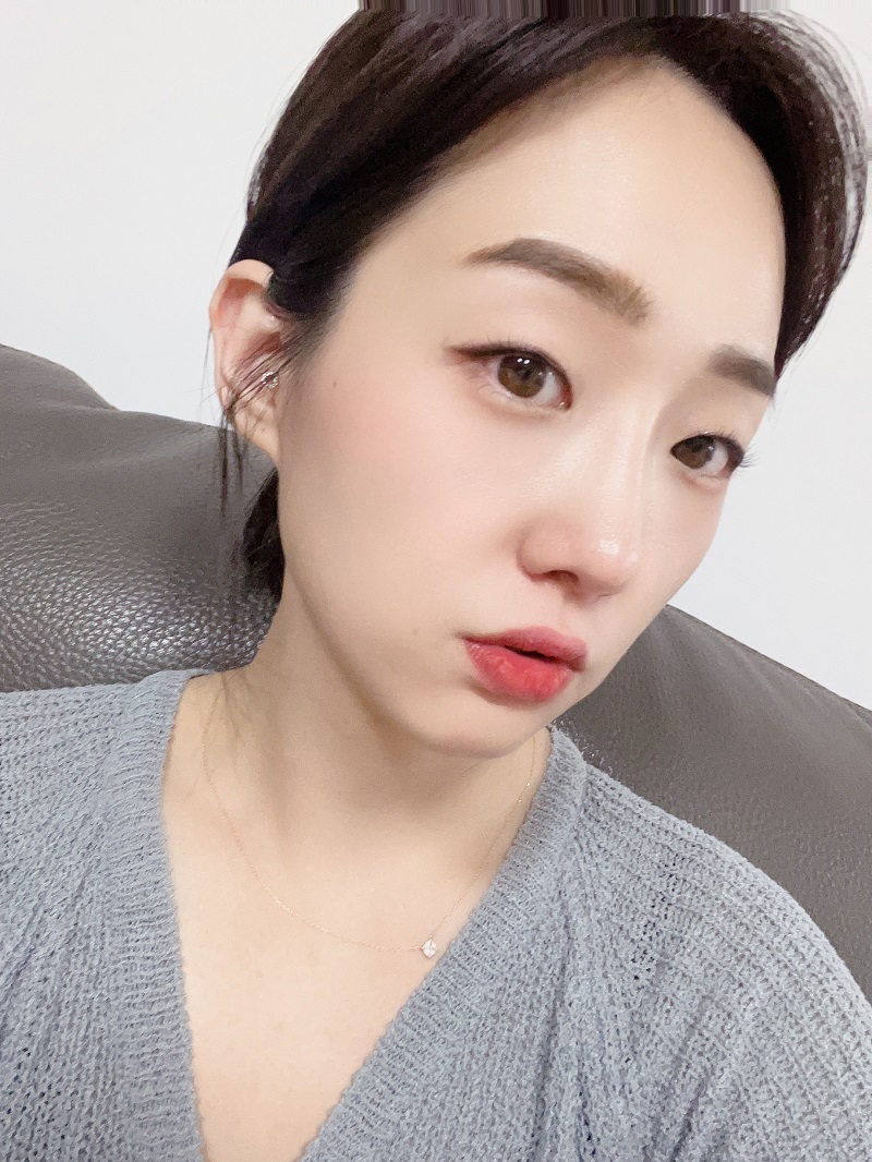 수술후기이미지