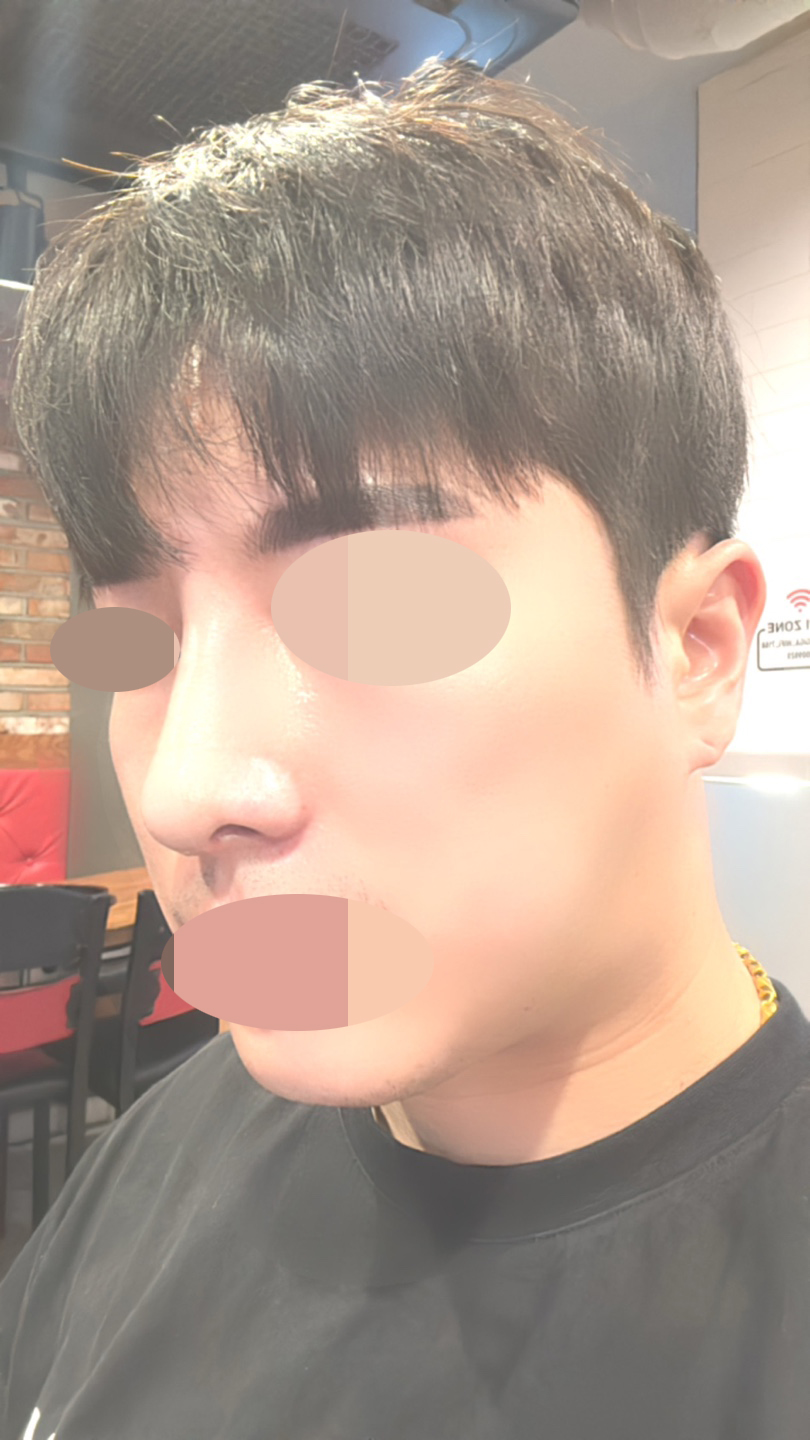 수술후기이미지