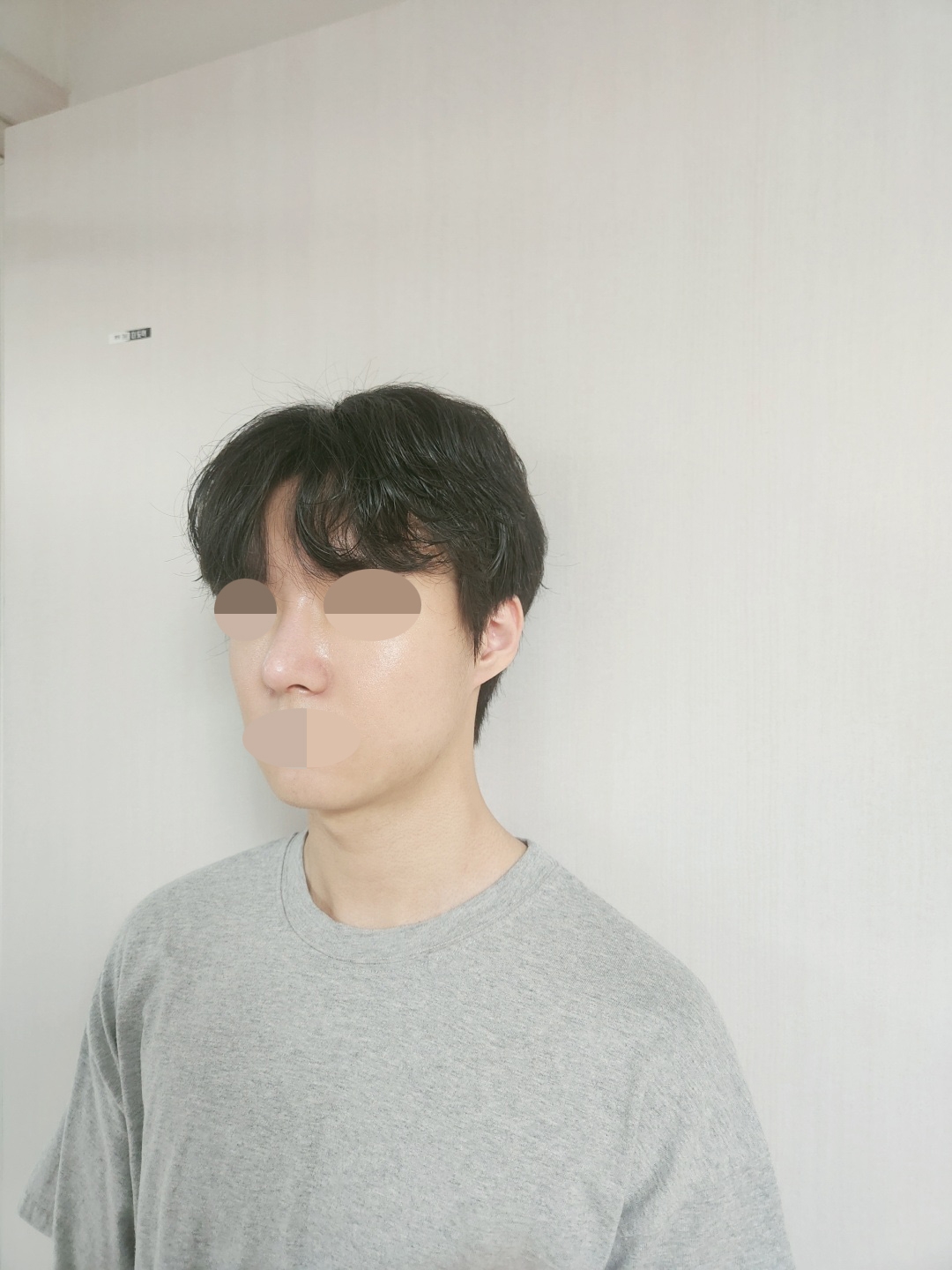 수술후기이미지