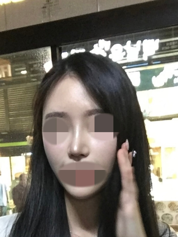 수술후기이미지