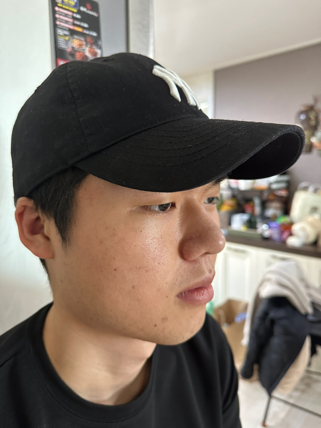 수술후기이미지