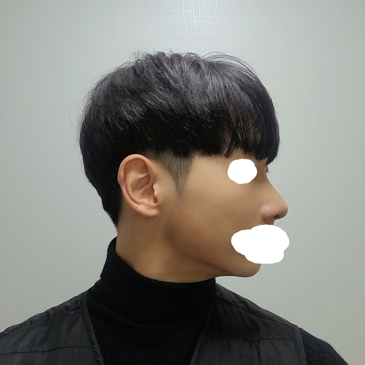 수술후기이미지