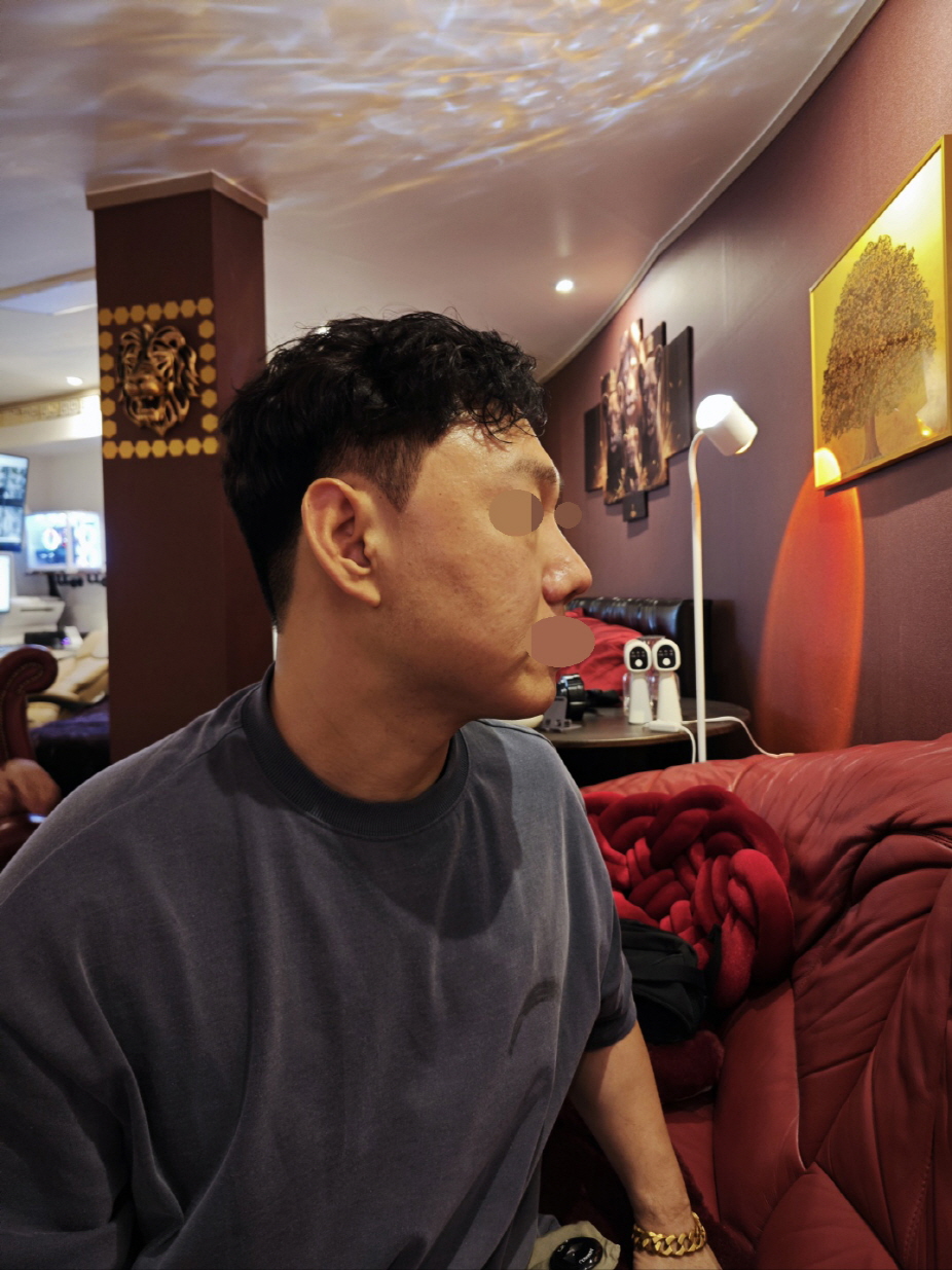 수술후기이미지