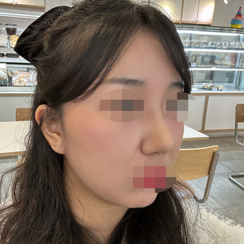 수술후기이미지