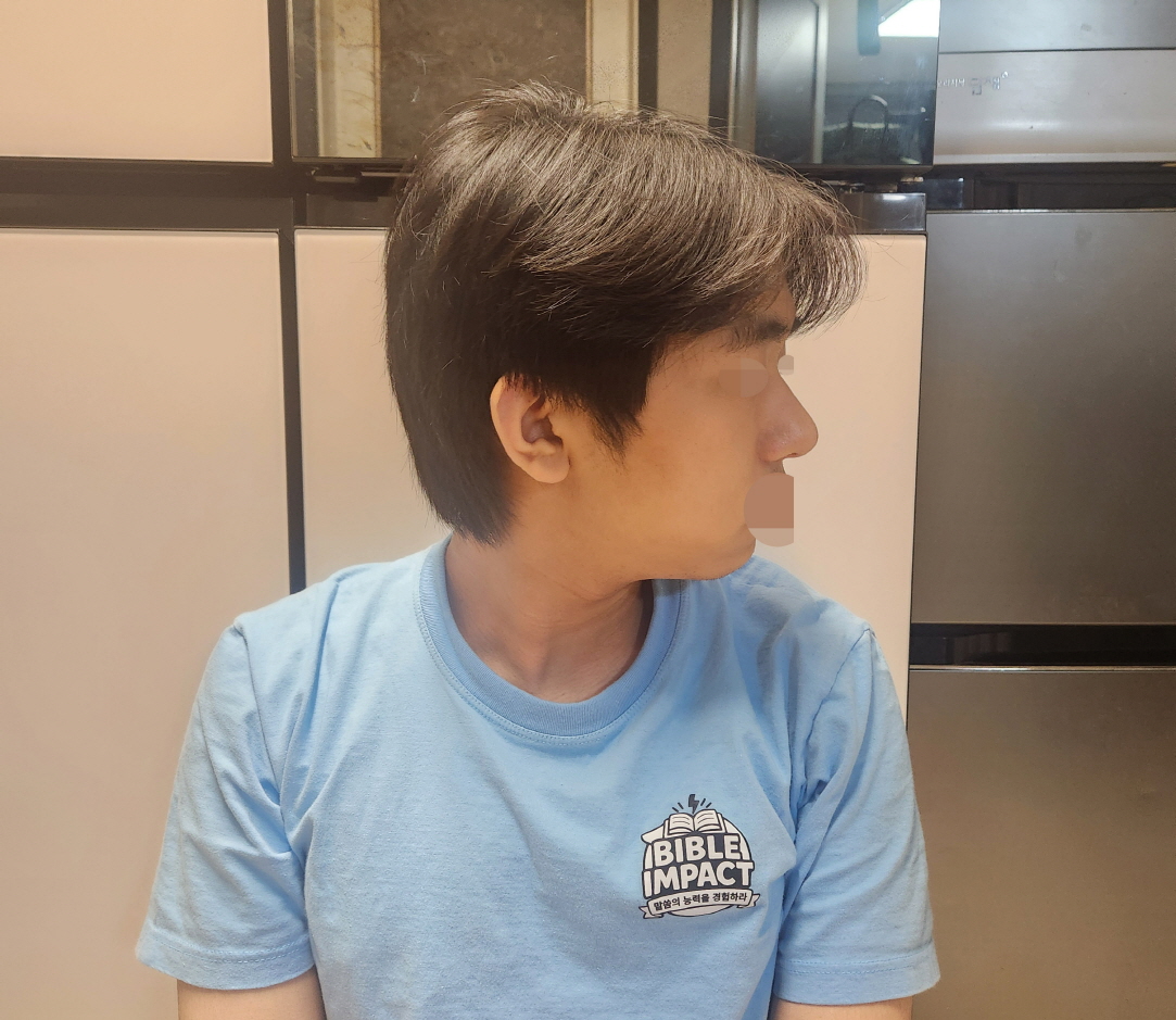 수술후기이미지