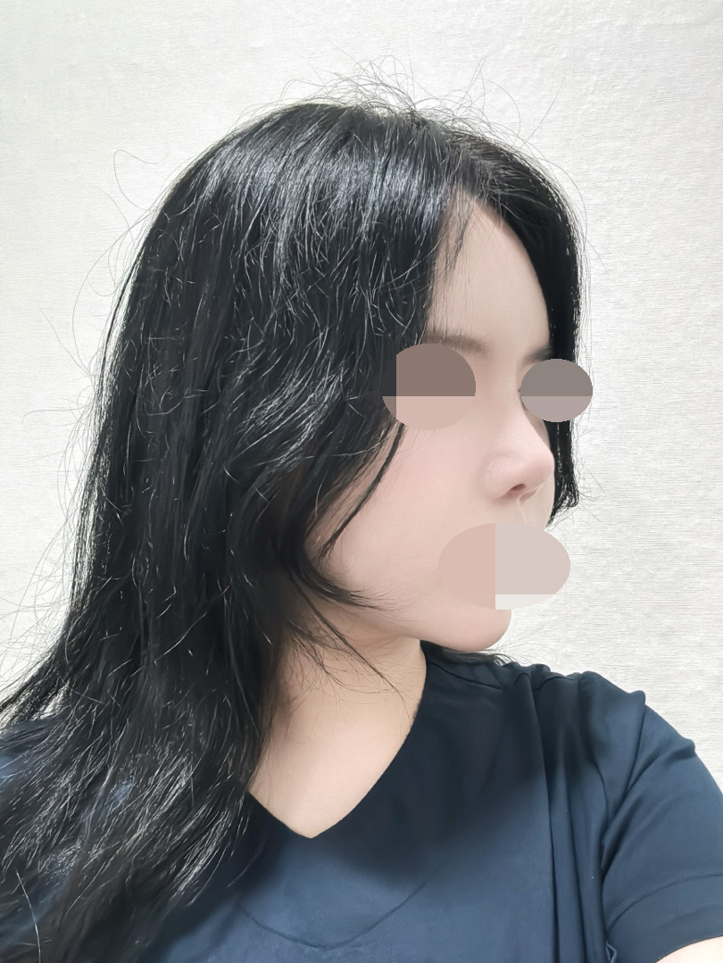 수술후기이미지