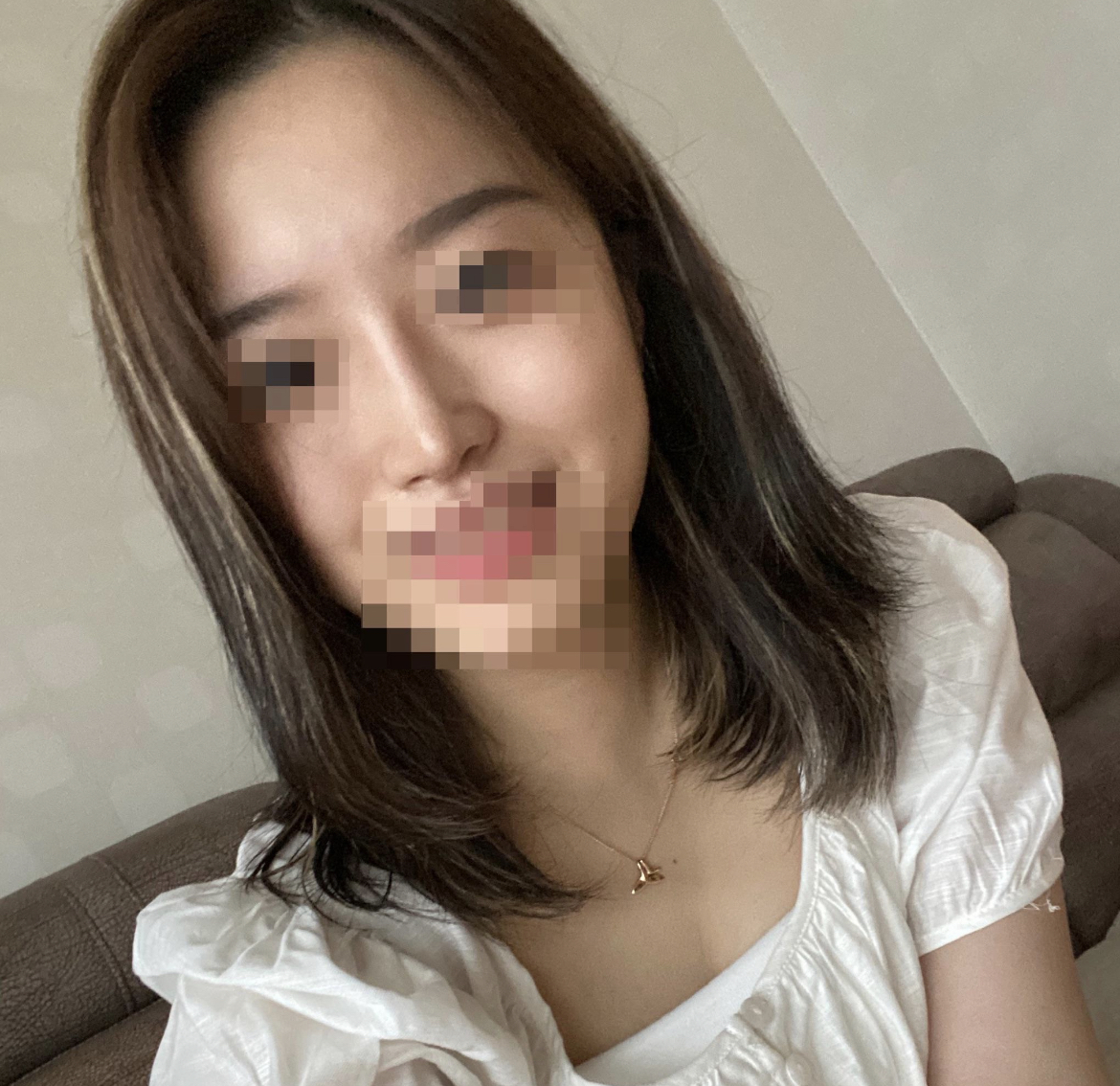 수술후기이미지