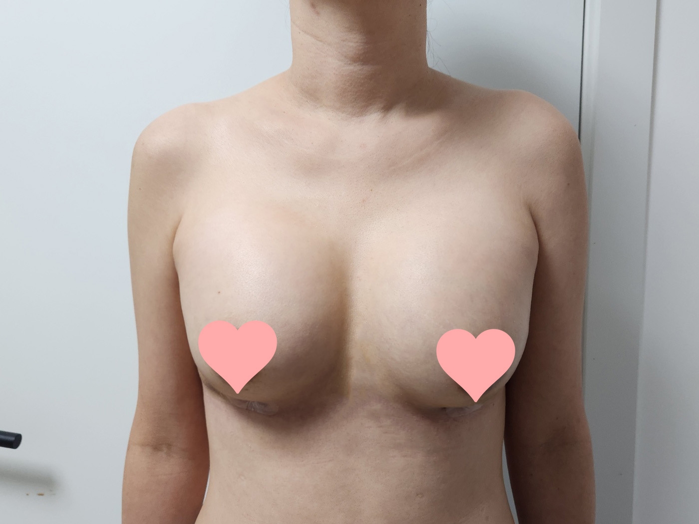 수술후기이미지