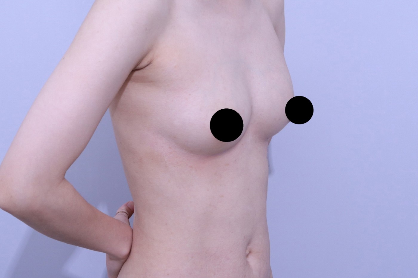 수술후기이미지