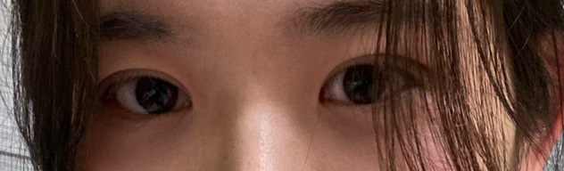 수술후기이미지