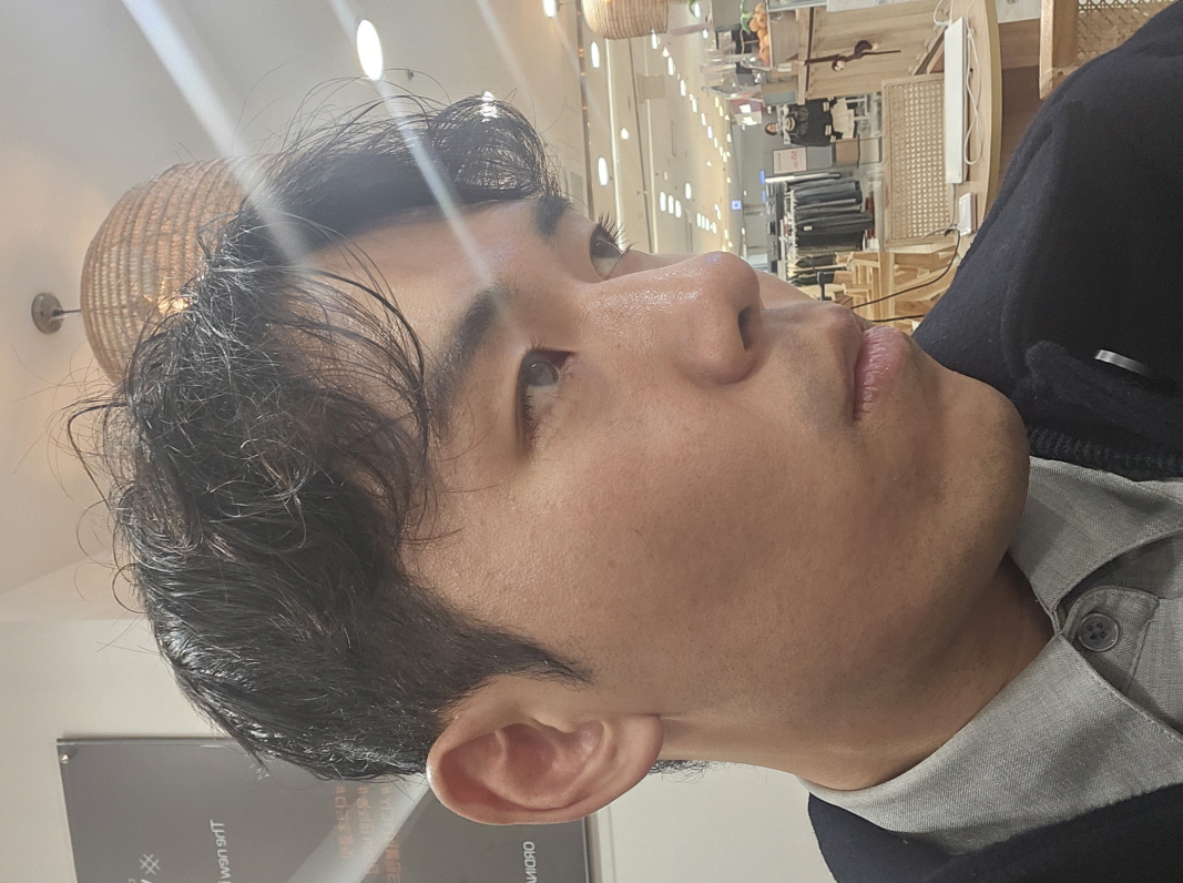 수술후기이미지