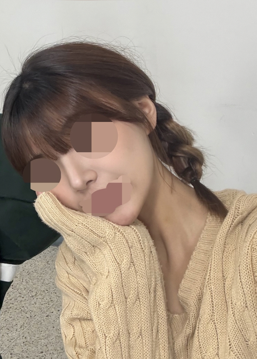 수술후기이미지