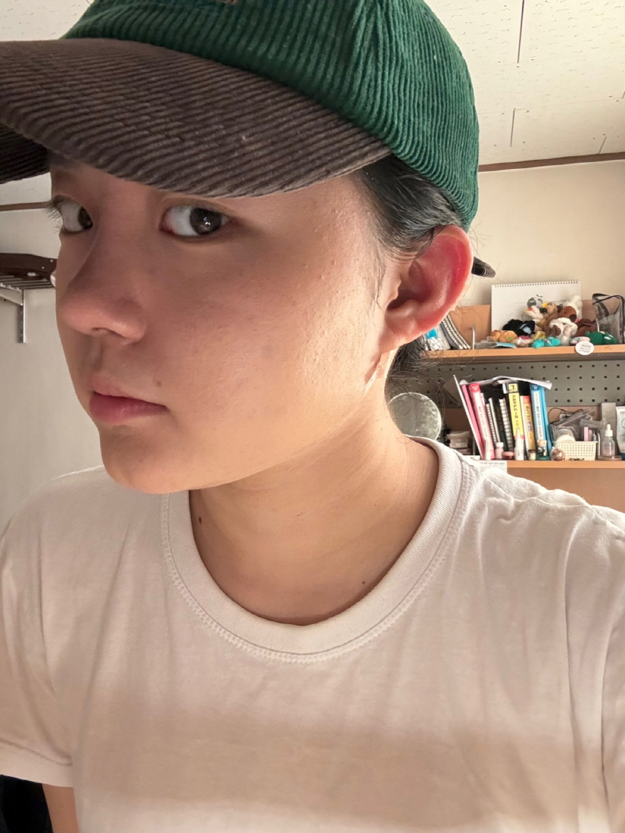 수술후기이미지