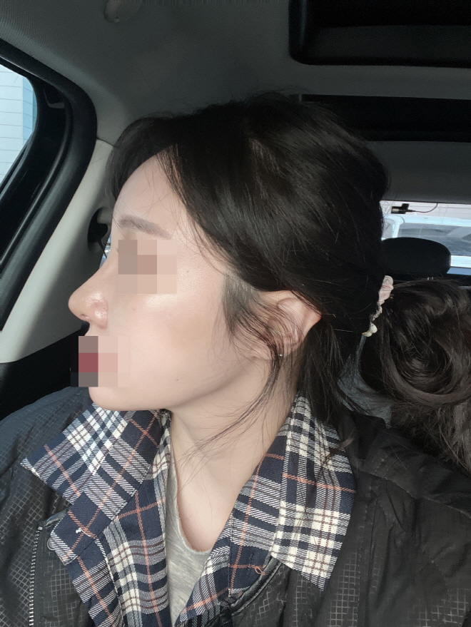 수술후기이미지