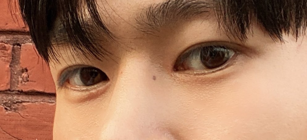 수술후기이미지