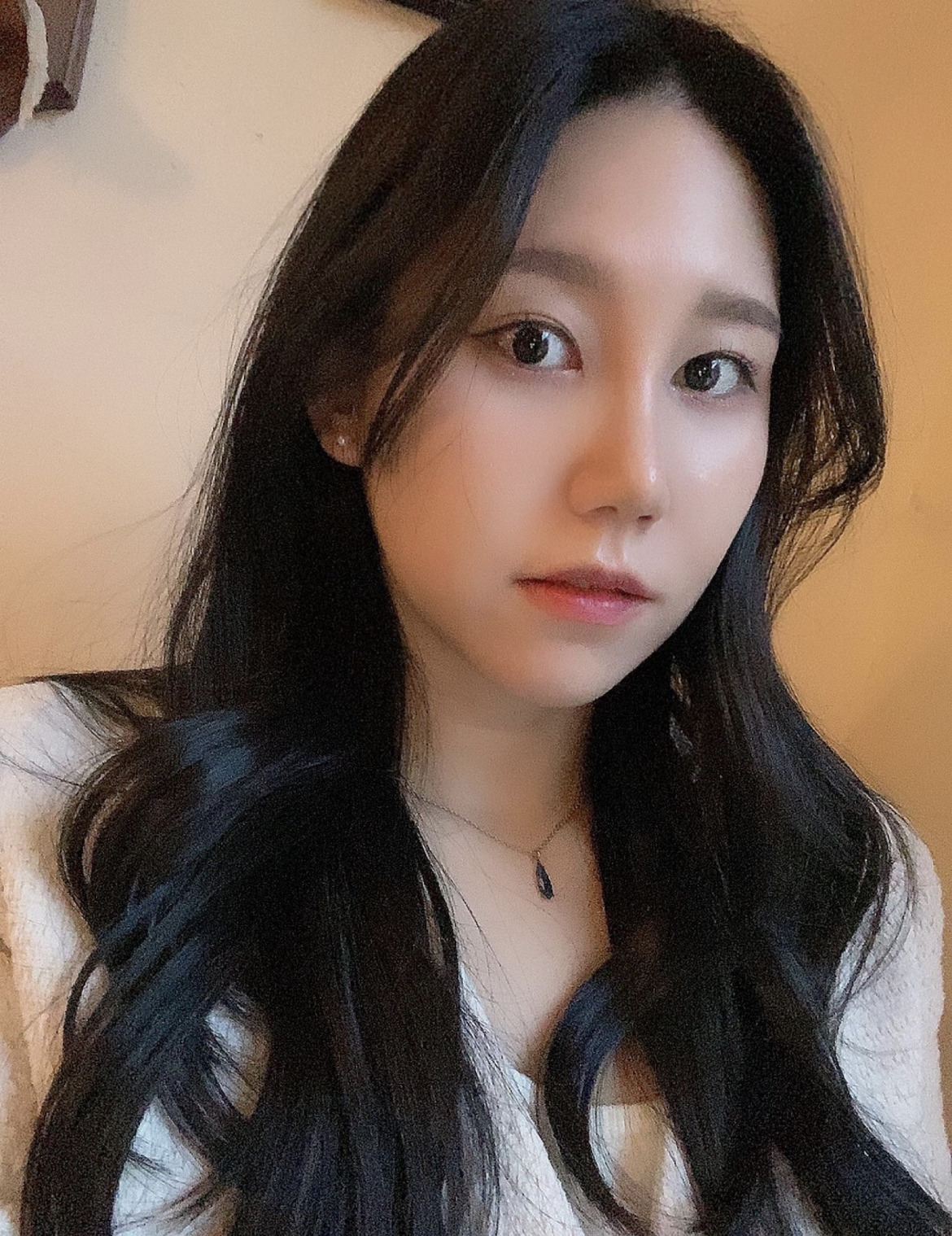 수술후기이미지