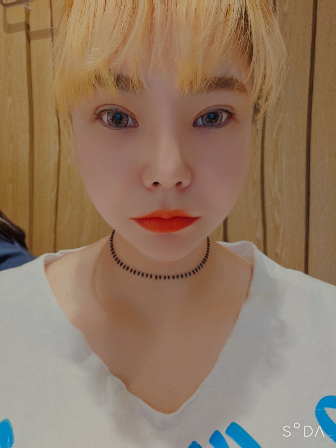 수술후기이미지