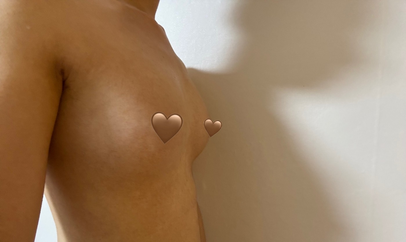 수술후기이미지