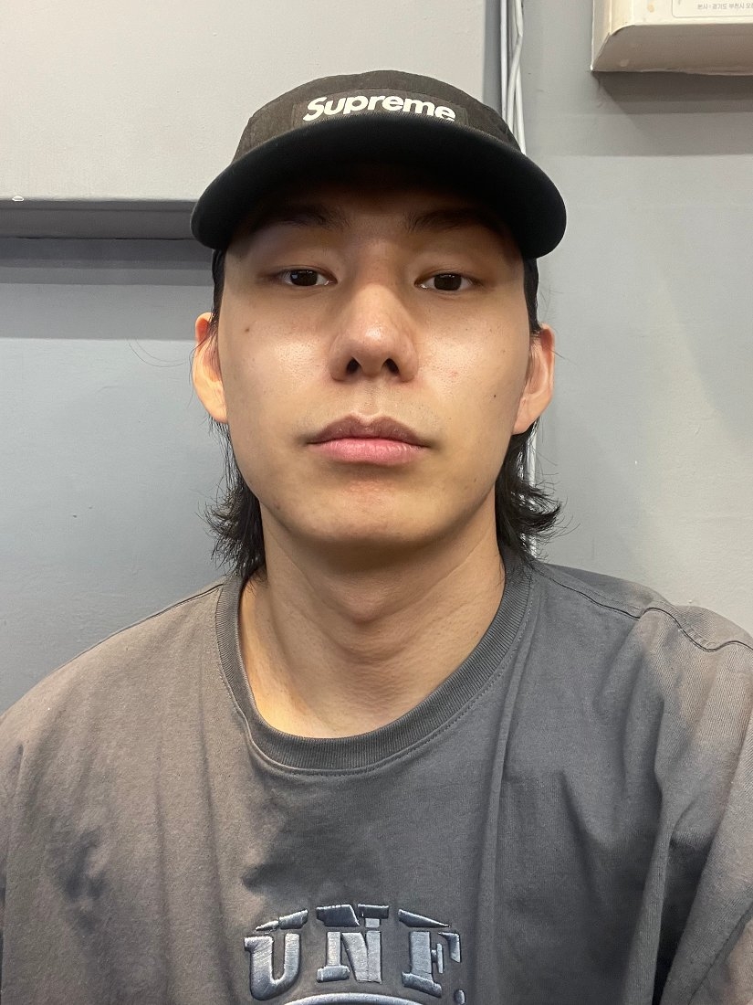 수술후기이미지