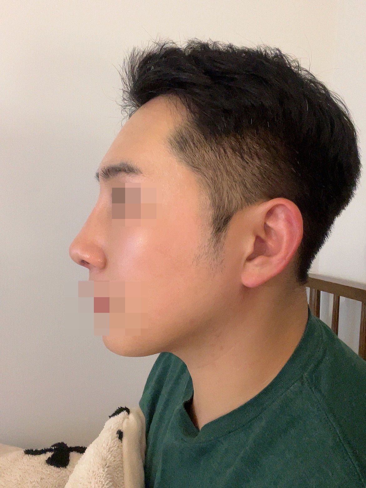 수술후기이미지