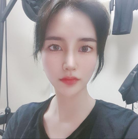 수술후기이미지