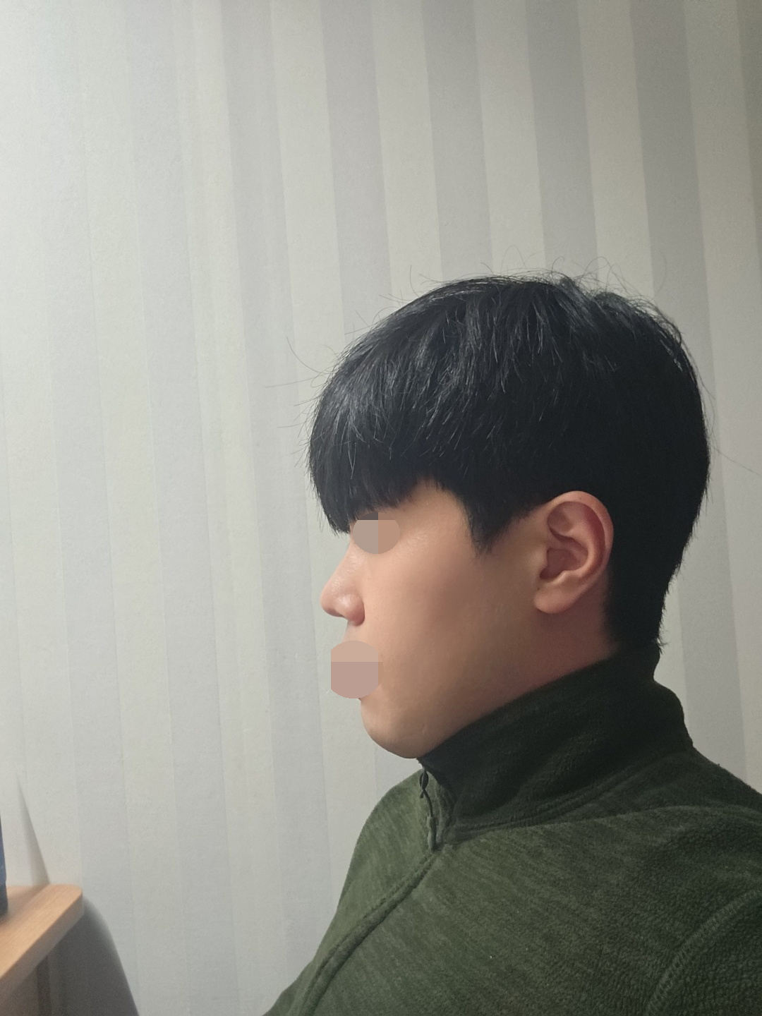 수술후기이미지