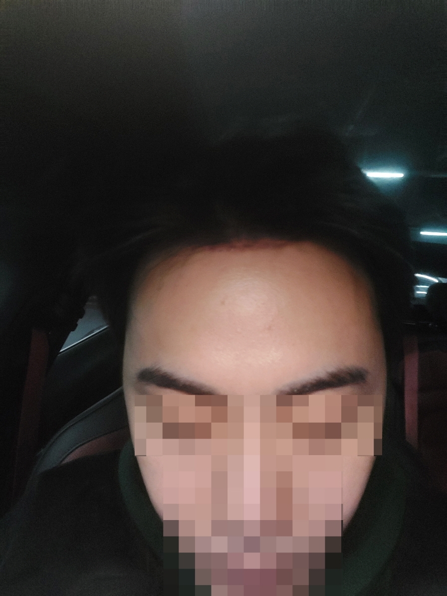 수술후기이미지