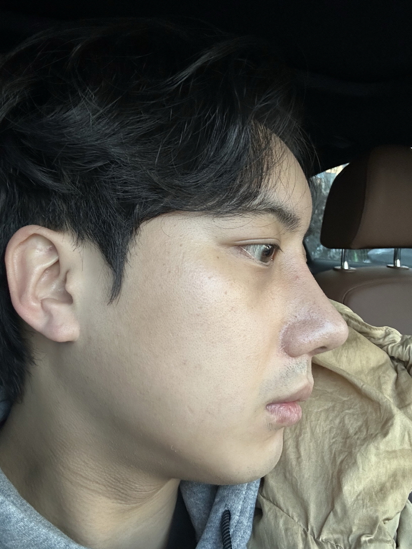 수술후기이미지