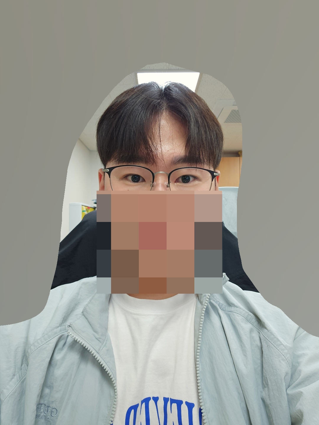 수술후기이미지