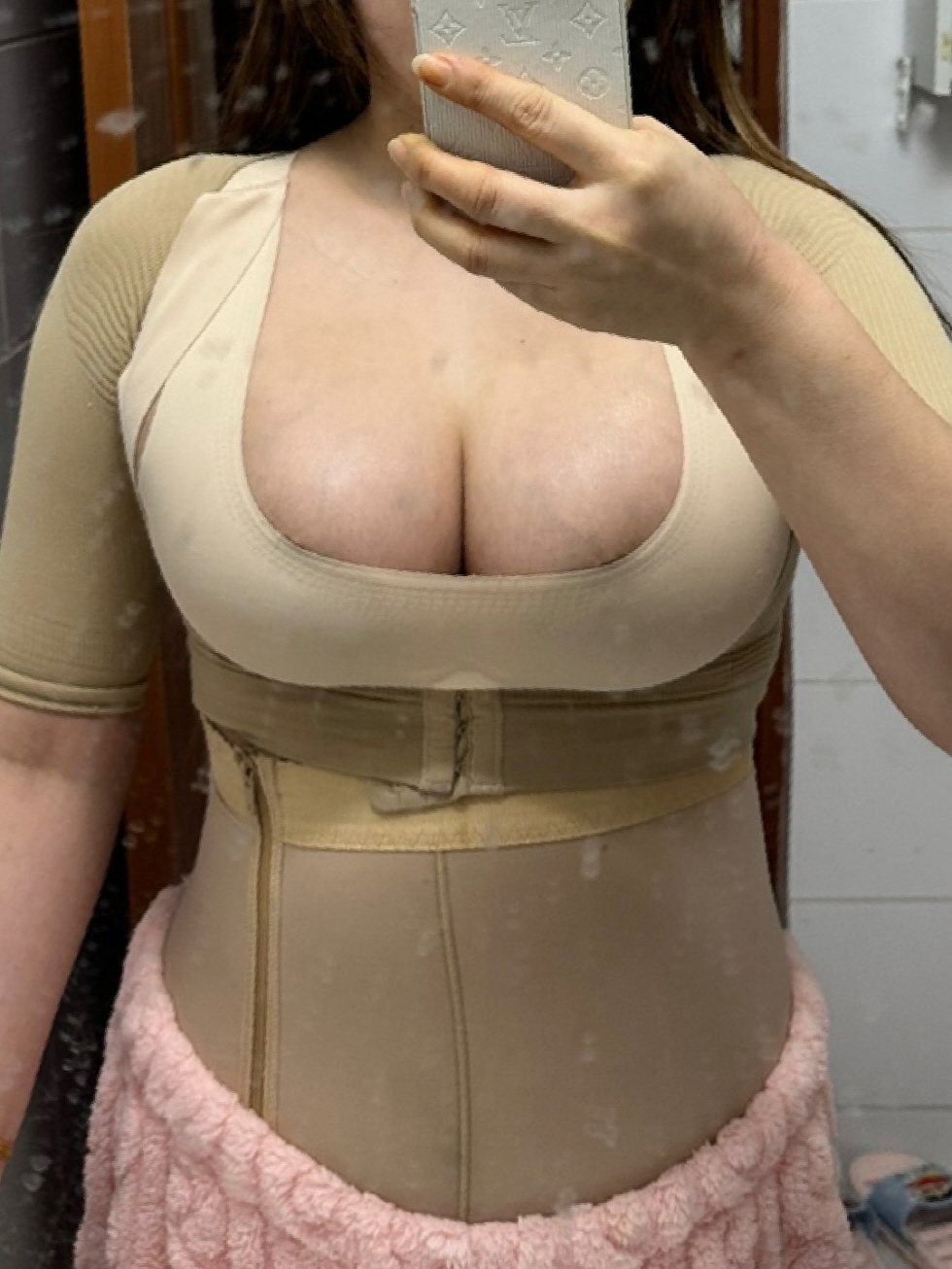 수술후기이미지